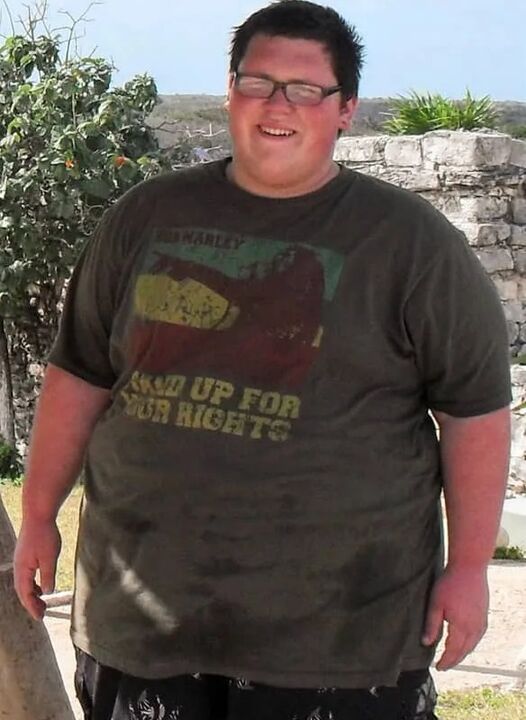 Obesità prima di usare keto probiox